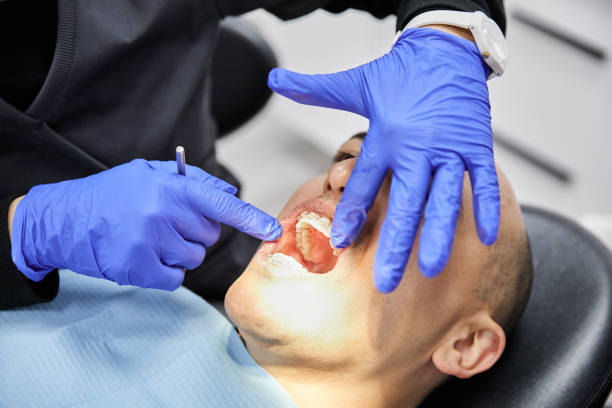 Best Emergency Dental Care for Abscessed Tooth in Su Oswego, NY